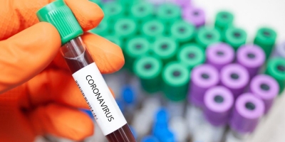 Троє жителів Кіровоградщини захворіли на коронавірус