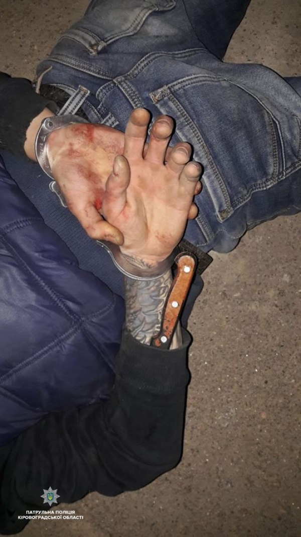 На 23-річного чоловіка напали з ножем у Кропивницькому