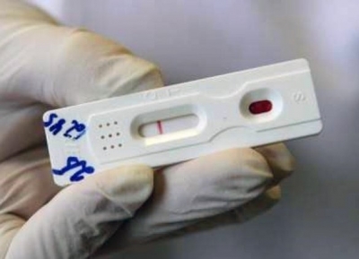 Кіровоградщина витратила найбільше коштів на швидкі тести вияву ВІЛ-інфекції (ІНФОГРАФІКА)
