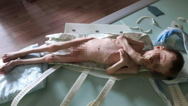 Депутат з Кіровоградщини намагався заморити голодом власного сина (ВІДЕО)