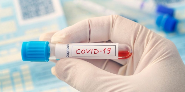 Кіровоградщина: кого тестуватимуть на COVID-19 першочергово
