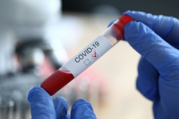 На Кіровоградщині за добу виявили понад 40 хворих на COVID-19