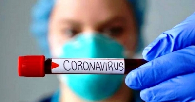 Кіровоградщина : ще 19 жителів області захворіли на COVID-19