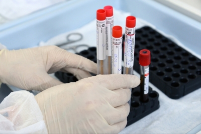 Кіровогращина: ще 28 випадків коронавірусу виявили за добу
