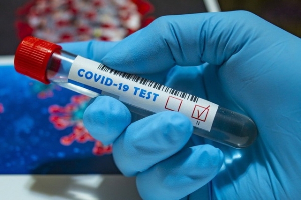 За добу від коронавірусу померло 4 осіб, 138 захворіло