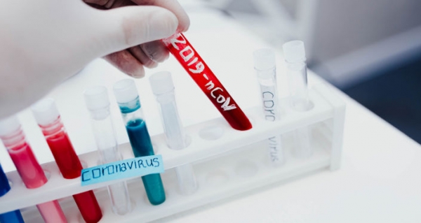 72 жителі Кіровоградщини захворіли на коронавірус