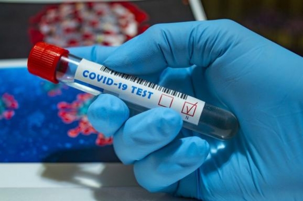 Ще 141 житель Кіровоградщини захворів на коронавірус