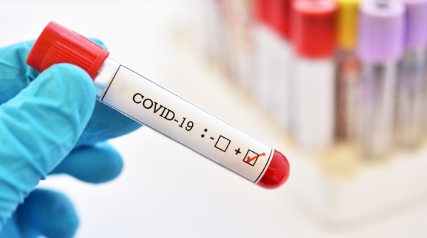 На Кіровоградщині підтвердили 20 нових випадків захворювання на COVID-19, 4 людей померли